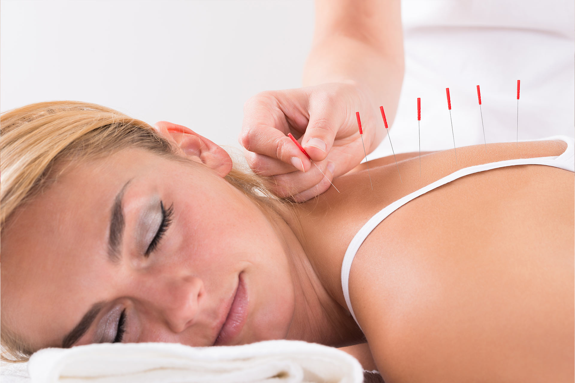 Calgary Acupuncture Therapy | Complete Health SW Calgary Chiropractor